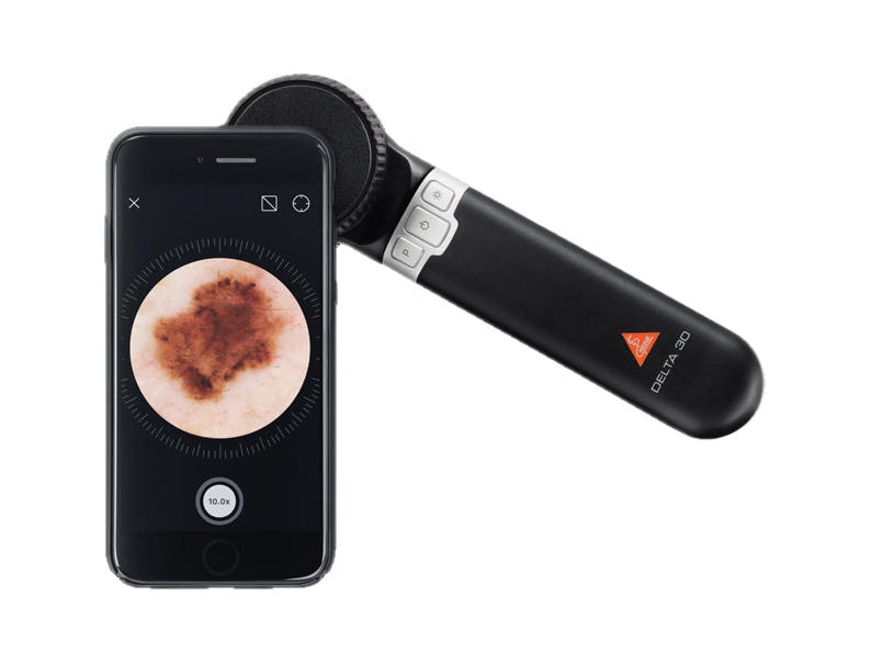 HEINE DELTA 30 Dermatoscope with iPhone