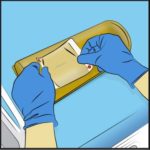CleanPatch-P Gel Positioner Repair Patch