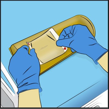 CleanPatch-P Gel Positioner Repair Patch
