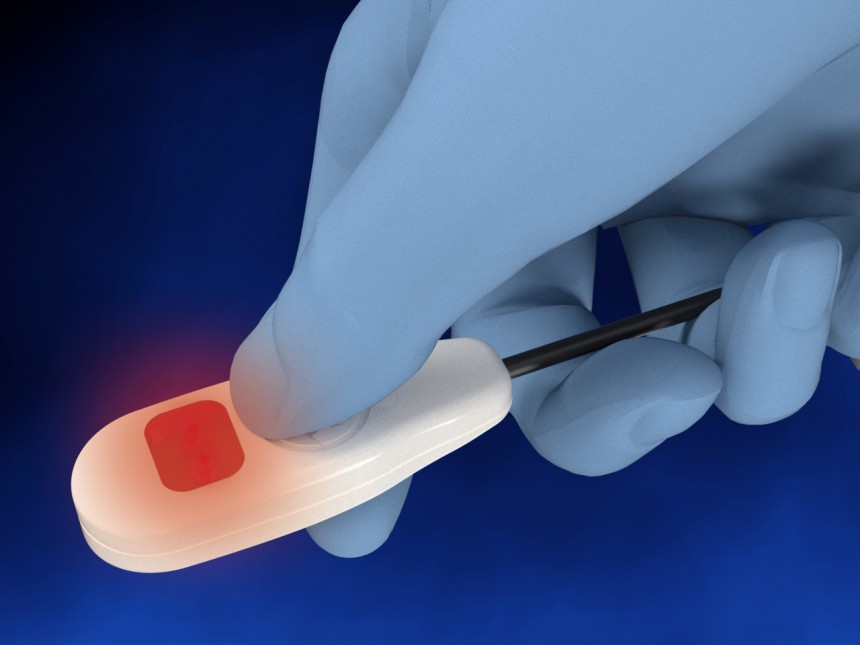 Neotech NeoGlo Disposable Transilluminator