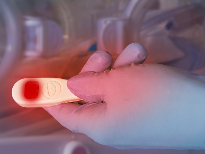 Neotech Neogrip Neotech NeoGlo® Disposable Transilluminator - Henleys Medical Supplies