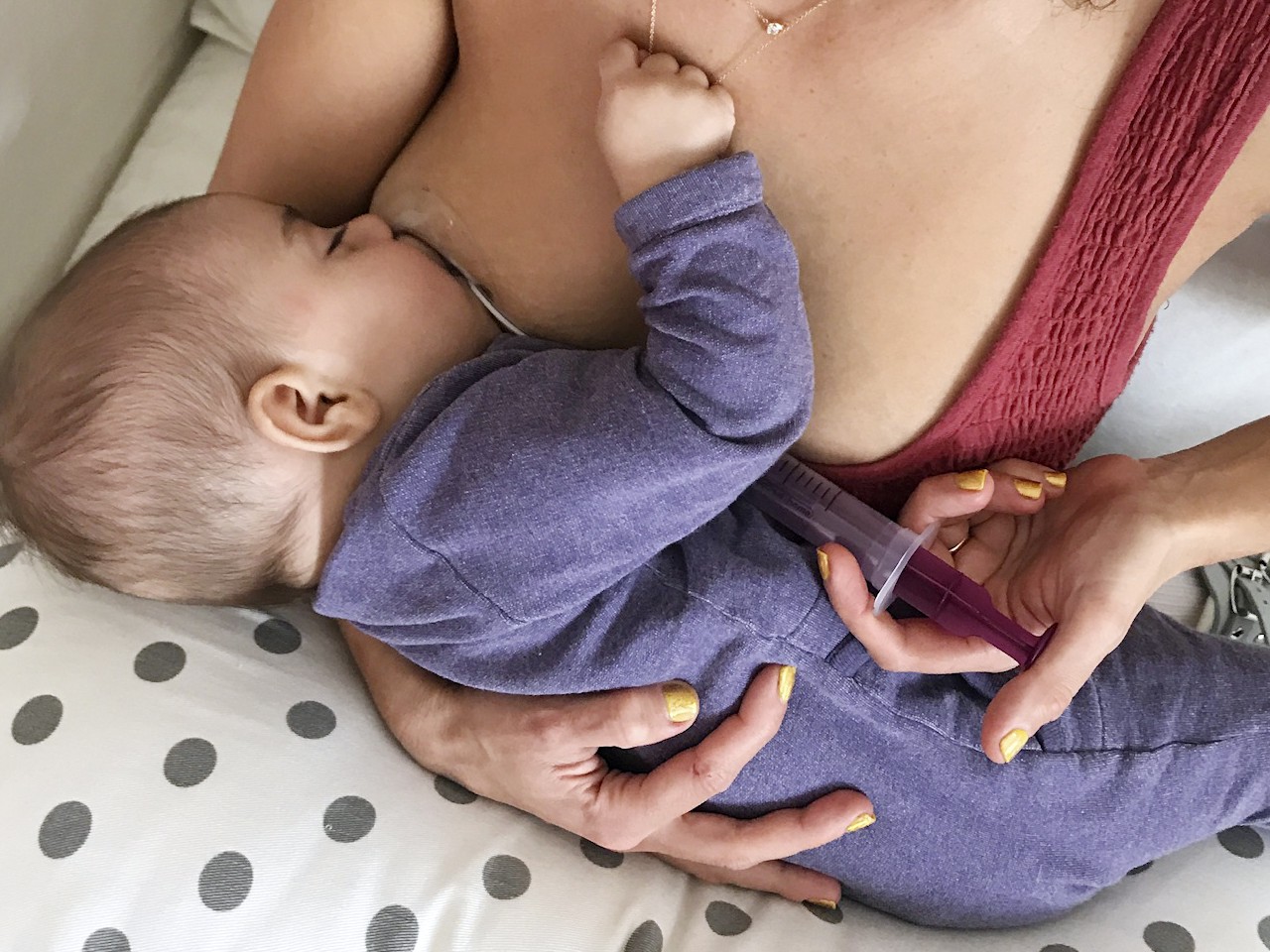 Neotech Bridge, Breastfeeding Assistance Device